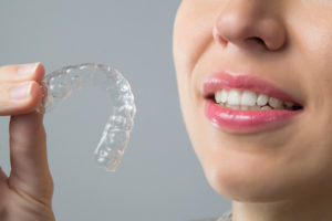 invisalign braces